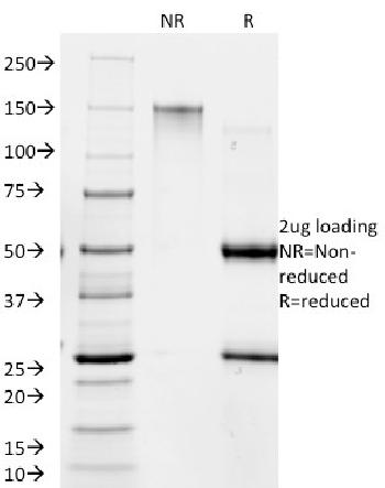 Anti-Giardia lamblia Monoclonal Antibody(Clone: BB1.1E5)