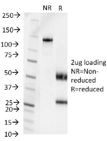 Anti-Pseudomonas aerµginosa serotype 6C Monoclonal Antibody(Clone: 1200/472)