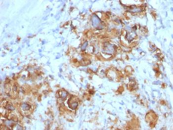 Anti-CA19-9/Sialyl Lewisa (GI Tumor Marker) Monoclonal Antibody(Clone: 121SLE)