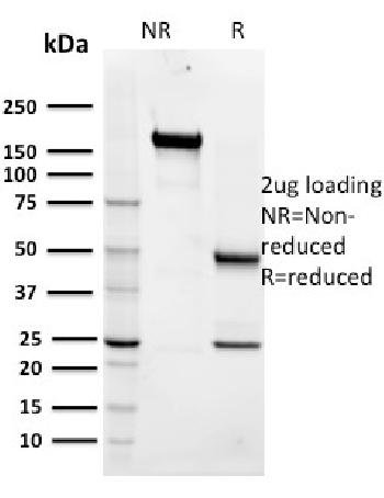 Anti-Maltose Binding Protein / MBP-probe Monoclonal Antibody(Clone: R29.6)