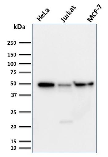 Anti-Cyclin A1 Monoclonal Antibody(Clone: XLA1-3)