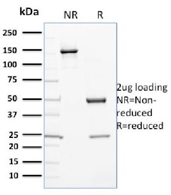 Anti-Cytochrome P450 3A1 / CYP3A1 Monoclonal Antibody(Clone: P6)