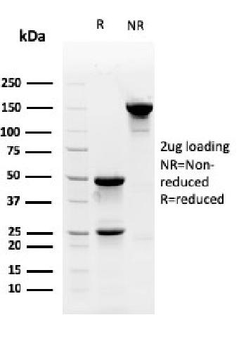 Anti-Myofibroblast Marker Monoclonal Antibody(Clone: PR 2D3)