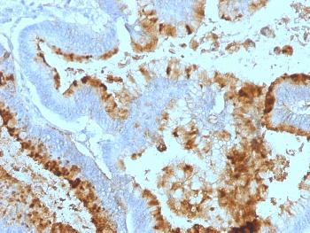 Anti-Lewis A (Blood Group Antigen) Monoclonal Antibody(Clone: 7LE)