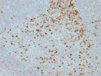 Anti-Proliferation Marker Monoclonal Antibody(Clone: JC1)