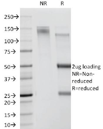 Anti-CDw78 Monoclonal Antibody(Clone: DF1588)