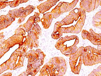 Anti-Cytokeratin, Multi (Epithelial Marker) Monoclonal Antibody(Clone: C11)