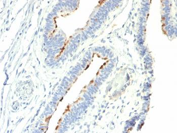 Anti-Thomsen-Friedenreich Antigen / CD176 (Pan Carcinoma Marker) Monoclonal Antibody(Clone: A78-G/A7)