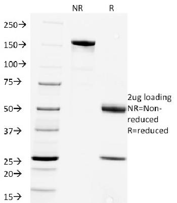 Anti-Rabies Virus Monoclonal Antibody(Clone: Rab-50)