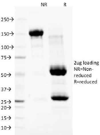 Anti-Nuclear Membrane Marker Monoclonal Antibody(Clone: NM97)