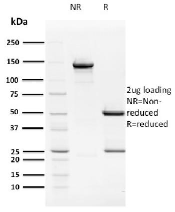 Anti-HPV16 E2 (Human Papilloma Virus 16) Monoclonal Antibody(Clone: TVG 261)