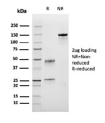 Anti-Bromodeoxyuridine (BrdU) (Proliferation Marker) Monoclonal Antibody(Clone: rBRD.3)