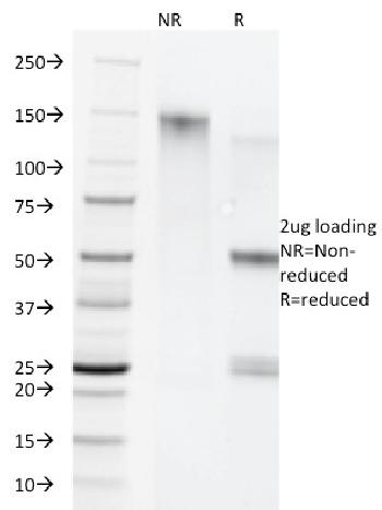 Anti-Cytokeratin 5/8 Monoclonal Antibody(Clone: C-50)