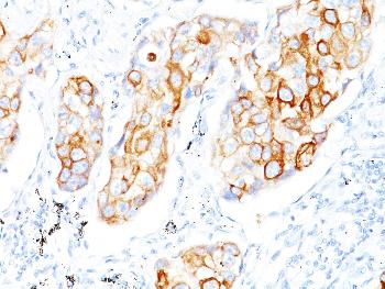 Anti-Cytokeratin 7/17 Monoclonal Antibody(Clone: C-46)