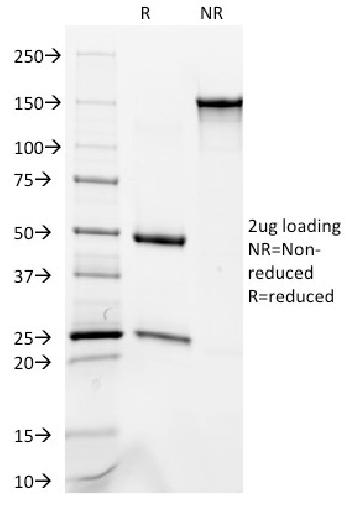 Anti-Cytokeratin 8/18 Monoclonal Antibody(Clone: C-51)