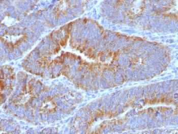 Anti-Thomsen-Friedenreich Antigen / CD176 (Pan Carcinoma Marker) Monoclonal Antibody(Clone: SPM320)