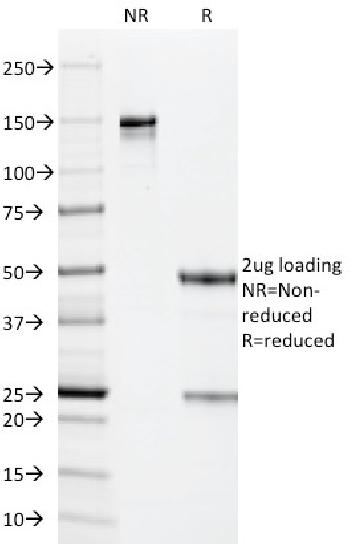 Anti-Cytomegalovirus p65 (CMV-p65) Monoclonal Antibody(Clone: CMV101)