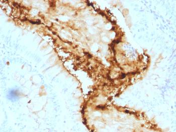 Anti-Lewis Y (Tumor Marker) Monoclonal Antibody(Clone: A70-A/A9)