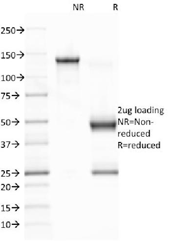 Anti-Epstein-Barr Virus (LMP-1) Monoclonal Antibody(Clone: CS1)