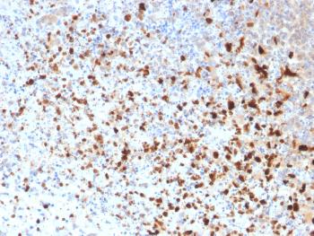 Anti-HSV1 (Herpes Simplex Virus Type I) Monoclonal Antibody(Clone: 10A3)