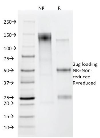 Anti-Helicobacter pylori Monoclonal Antibody(Clone: HP/212)