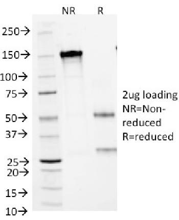 Anti-Small Cell Lung Carcinoma Antigen (SCLC Marker) Monoclonal Antibody(Clone: MOC-52)