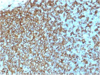 Anti-HLA-Pan (MHC II) Monoclonal Antibody(Clone: rHLA-Pan/3475)