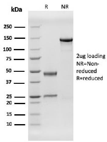 Anti-Human Herpes Virus 8 (HHV8) Monoclonal Antibody(Clone: HHV8/3606)