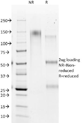 Anti-Hepatocyte Specific Antigen (Hepatocellular Marker) Monoclonal Antibody(Clone: HSA98)