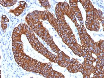 Anti-Cytokeratin 8/18 Monoclonal Antibody(Clone: KRT8.18/1346)