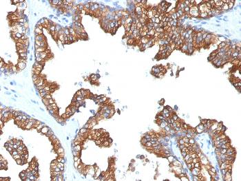 Anti-Cytokeratin 8/18 Monoclonal Antibody(Clone: 5D3)