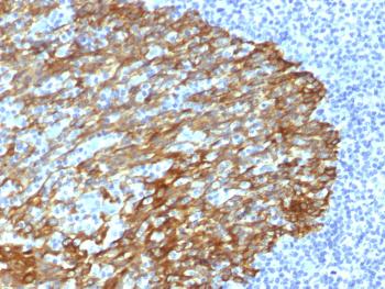 Anti-Cytokeratin, Basic (Type II or HMW) Monoclonal Antibody(Clone: DE-SQ)