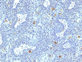 Anti-HPV-16 (Human Papilloma Virus 16) Monoclonal Antibody(Clone: HPV16/1295)