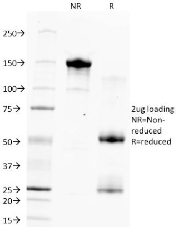 Anti-Hepatocyte Specific Antigen (Hepatocellular Marker) Monoclonal Antibody(Clone: HSA133)