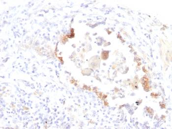 Anti-Lewis Y (Tumor Marker) Monoclonal Antibody(Clone: LWY/1463)