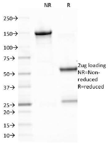 Anti-Epstein-Barr Virus (LMP-1) Monoclonal Antibody(Clone: CS2)