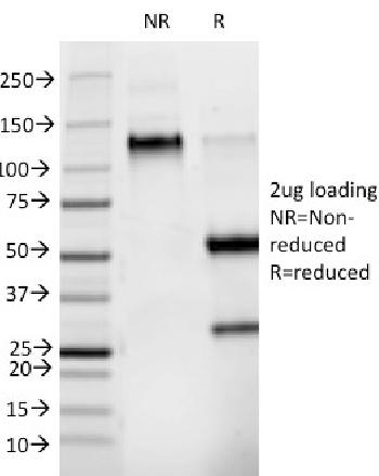 Anti-Phosphotyrosine (P-Tyr) Monoclonal Antibody(Clone: PY265)