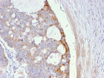 Anti-Thomsen-Friedenreich Antigen / CD176 (Pan Carcinoma Marker) Monoclonal Antibody(Clone: A63-C/A9)