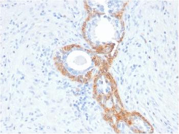 Anti-Cytokeratin, Basic (Type II or HMW) Monoclonal Antibody(Clone: rKRTH/2148)