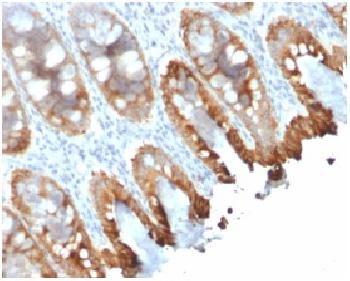 Anti-Cytokeratin 8/18 Monoclonal Antibody(Clone: rKRT8.18/1346)