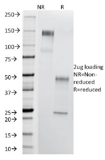 Anti-Thomsen-Friedenreich Antigen / CD176 (Pan Carcinoma Marker) Monoclonal Antibody(Clone: A84-A/F10)