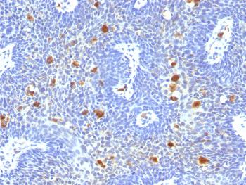 Anti-HPV-16 (Human Papilloma Virus 16) Monoclonal Antibody(Clone: HPV16/1296)