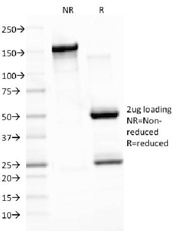 Anti-Epstein-Barr Virus (LMP-1) Monoclonal Antibody(Clone: CS3)