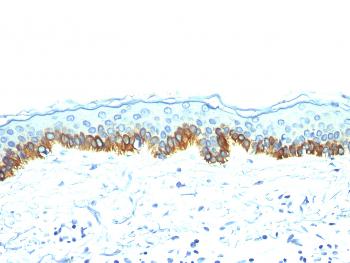 Anti-Cytokeratin, Acidic (Type I or LMW) (Epithelial Marker) Monoclonal Antibody(Clone: AE-1)