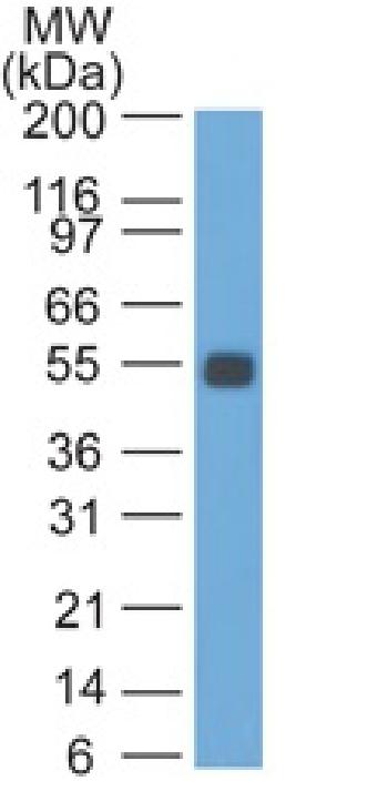 Anti-Ep-CAM / CD326 (Rat) Monoclonal Antibody(Clone: GZ-1)