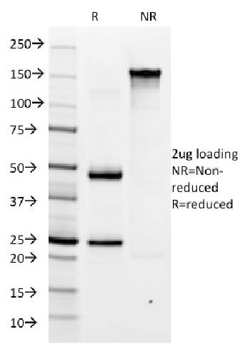 Anti-Helicobacter pylori Monoclonal Antibody(Clone: HP/1335)