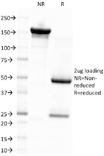 Anti-Epstein-Barr Virus (LMP-1) Monoclonal Antibody(Clone: CS4)