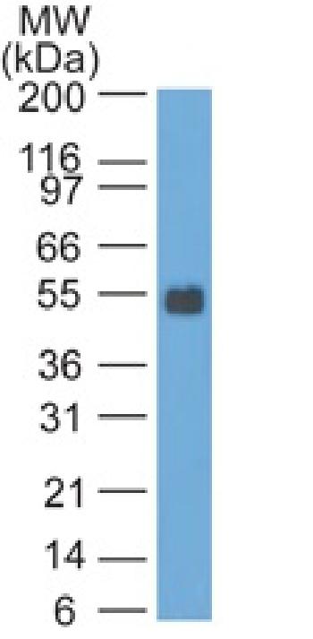 Anti-Ep-CAM / CD326 (Rat) Monoclonal Antibody(Clone: GZ-20)