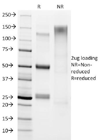 Anti-Helicobacter pylori Monoclonal Antibody(Clone: HP/1336)