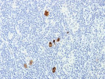 Anti-Epstein-Barr Virus (LMP-1) Monoclonal Antibody(Clone: CS1-4)